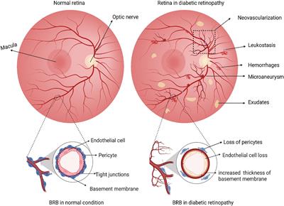 Cell and molecular targeted therapies for diabetic retinopathy